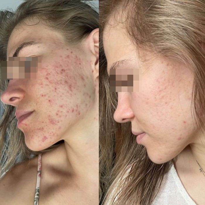 Derma Origin Cold Plasma Renew